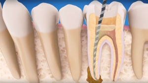 Endodontic Certificate Course And Endodontic Courses in Indi